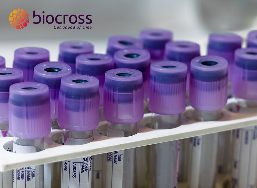 Biocross presents a fast and cost-effective method for apolipoprotein E isotyping for patient stratification in clinical trials