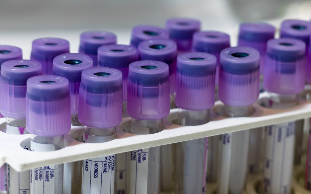 La compañía biotecnológica Biocross presentará un innovador test para la determinación en 10 minutos del riesgo de desarrollar la enfermedad de Alzheimer